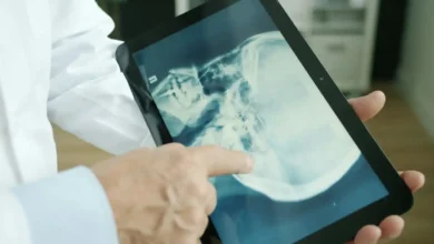 Maximizing Compensation for Personal Injury Victims